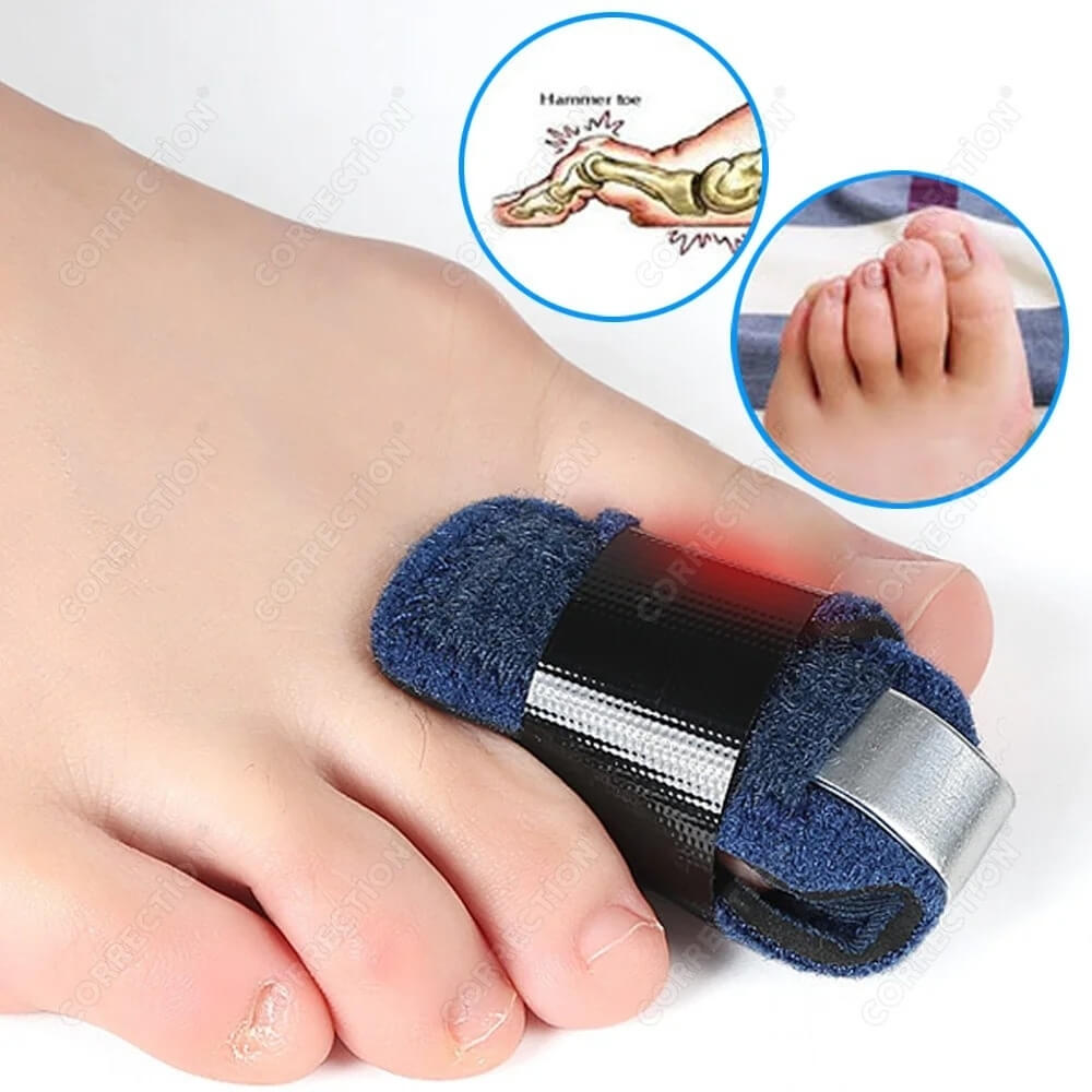 ToeRelief™ – Corector Ortopedic pentru Degete Suprapuse și Deget în Ciocan